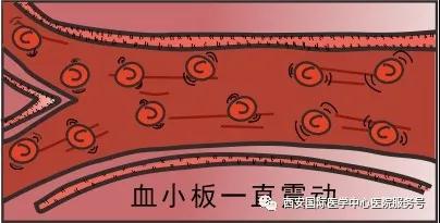 【科普】血小板是正常值的三倍？專家提醒小心血栓和出血！