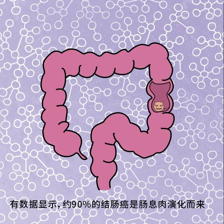 奪走“黑豹”生命的結(jié)腸癌，到底什么來頭？