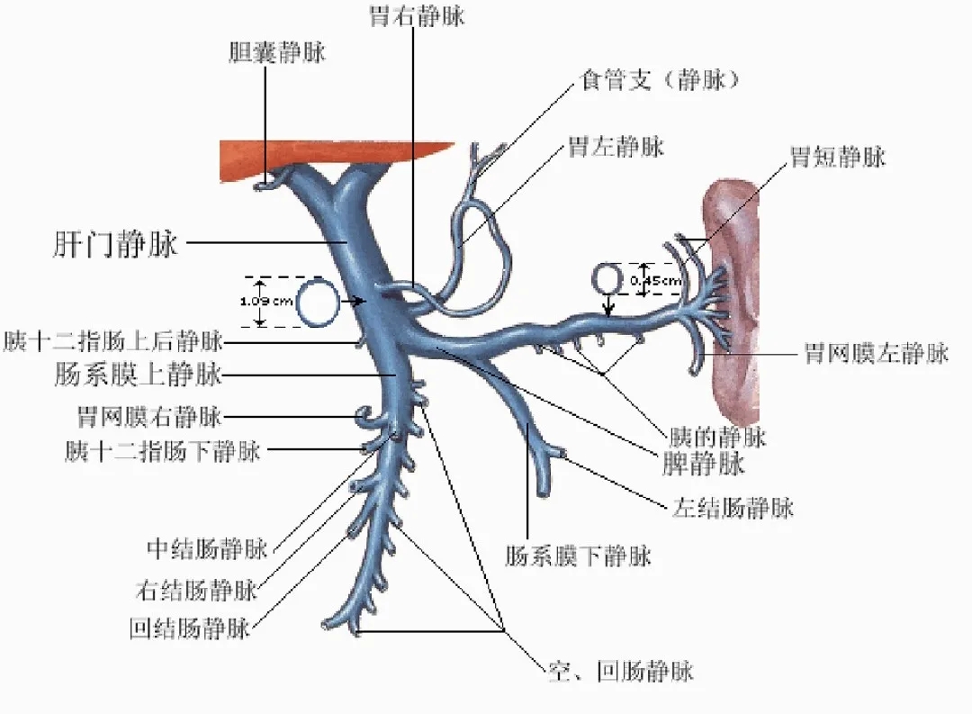 反復(fù)嘔血、黑便怎么辦？TIPS手術(shù)能解決