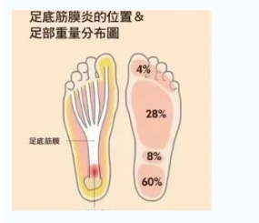 每年新生數(shù)百萬足底筋膜炎患者！國際醫(yī)學專家提醒：跑步要選擇合適的鞋